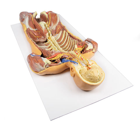 Peretele corporal posterior / Disecție profundă ventrală