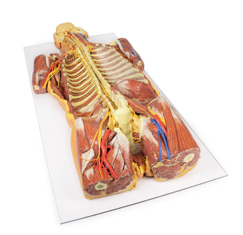 Peretele corporal posterior / Disecție profundă ventrală