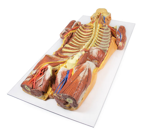 Peretele corporal posterior / Disecție profundă ventrală