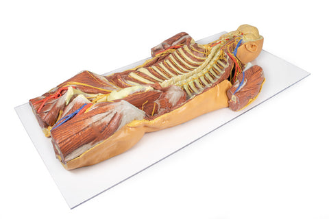 Peretele corporal posterior / Disecție profundă ventrală