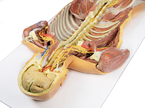 Peretele corporal posterior / Disecție profundă ventrală