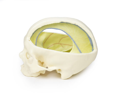 Craniu cu dura mater