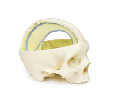Craniu cu dura mater