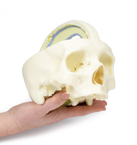 Craniu cu dura mater