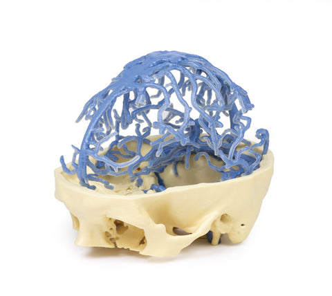 Anatomie imprimată 3D - Circulația venoasă