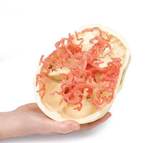 Anatomie tipărită 3D - Circulația arterială