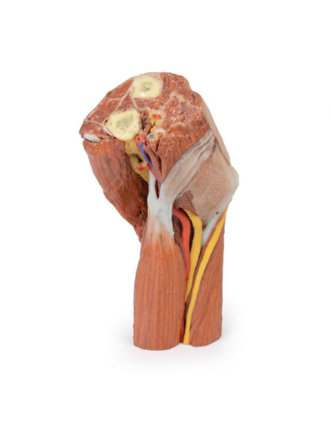 Fosa cubitală - mușchi, nervi mari și artera brahială