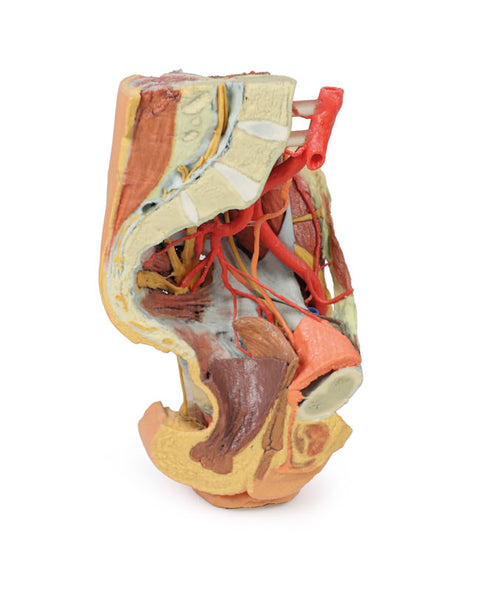 Pelvis stâng feminin și coapsa proximală