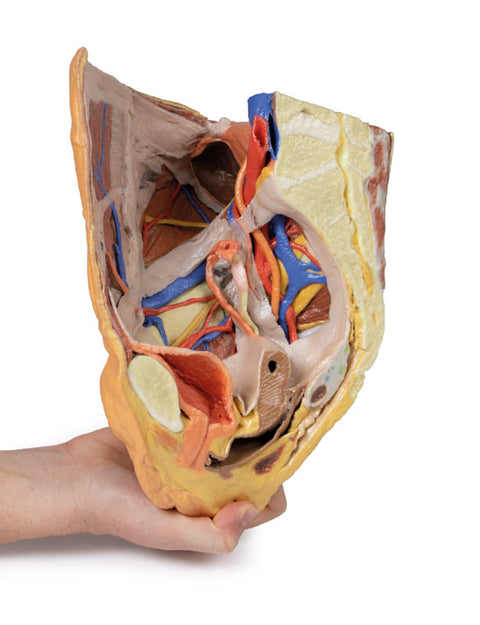 Pelvis drept feminin – structuri superficiale și profunde