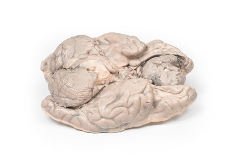 Meningiom