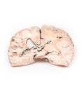 Infarct cerebral stâng