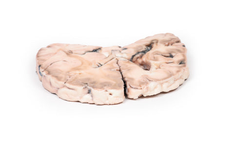 Infarct cerebral stâng