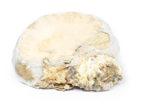 Adenom hipofizar