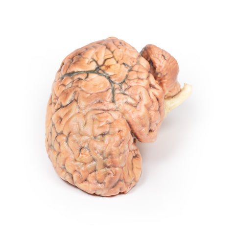 Craniofaringiom