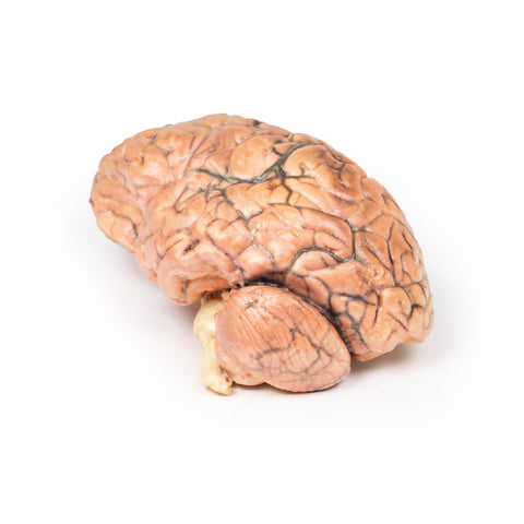 Craniofaringiom