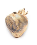 Defect septal atrial