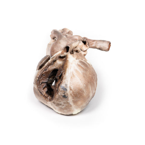 Tetralogia Fallot
