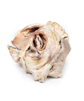 Stenoză valvulară aortică calcificată – valvă aortică bicuspidă