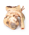 Anevrism sifilitic