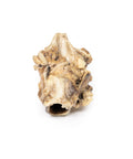 Carcinom al sinusului piriform