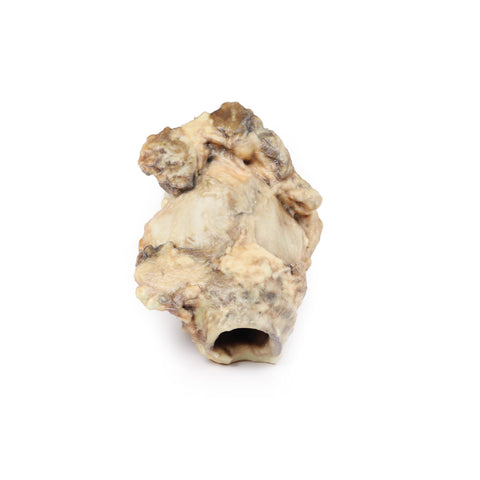 Carcinom al sinusului piriform
