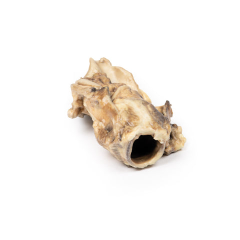 Carcinom al sinusului piriform