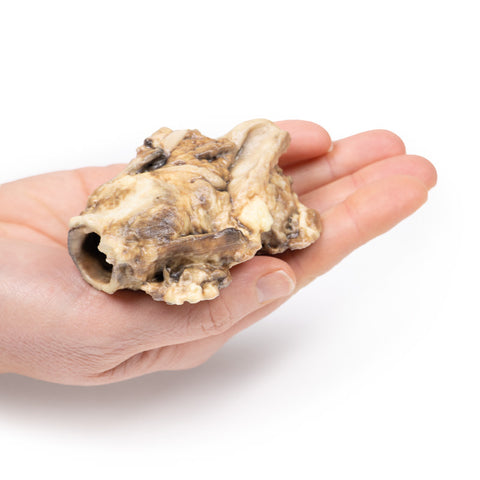Carcinom al sinusului piriform