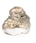 Tuberculoză fibrocazeoasă
