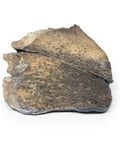 Bronhopneumonie