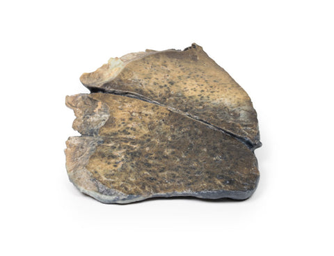 Bronhopneumonie