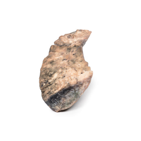 Plămân — fibroză chistică