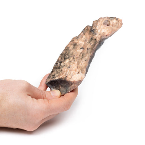 Plămân — fibroză chistică
