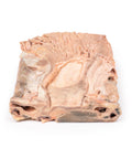 Ulcer gastric cronic