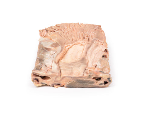 Ulcer gastric cronic