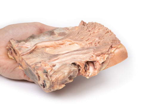 Ulcer gastric cronic