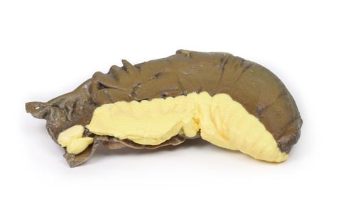 Invaginație a intestinului subțire cauzată de o tumoare metastatică