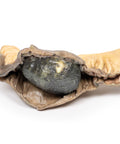 Ileus biliar