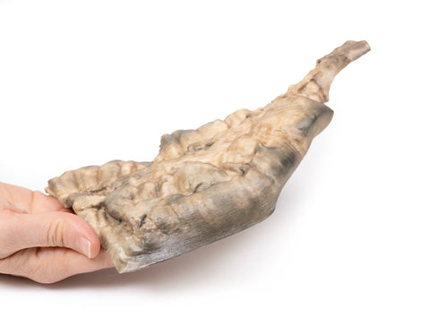 Boala Hirschsprung