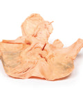 Adenocarcinom gastric