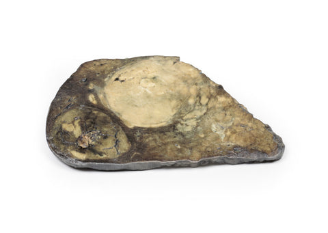 Carcinom hepatocelular
