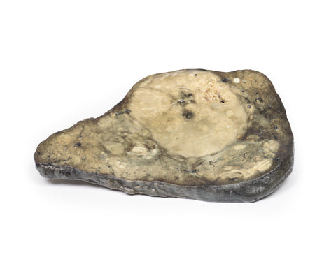 Carcinom hepatocelular