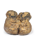 Carcinom renal cu celule clare