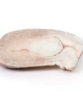 Leiomiom uterin