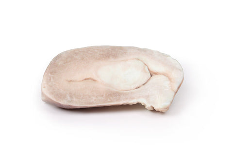 Leiomiom uterin