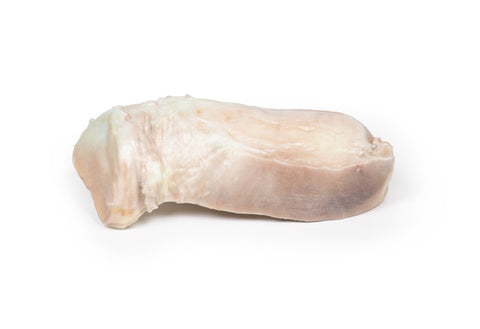 Leiomiom uterin