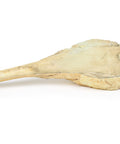 Osteosarcom al femurului