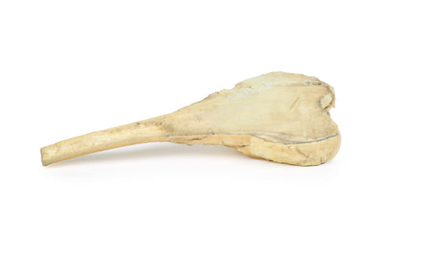 Osteosarcom al femurului