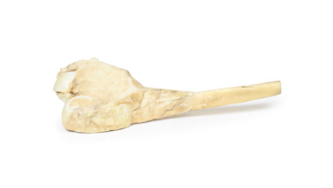 Osteosarcom al femurului