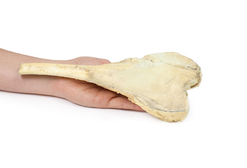 Osteosarcom al femurului