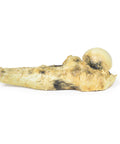 Osteosarcom femural